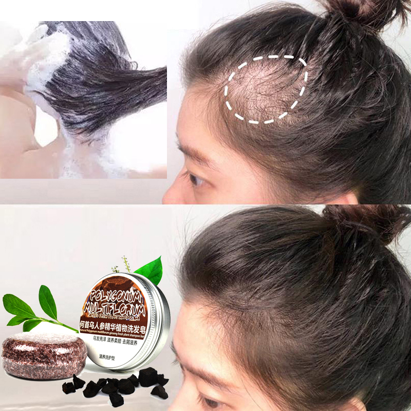 60g 유기농 천연 비누바 헤어 성장 고체 샴푸 컨디셔 - Bar Soap Shampoo Solid 리뷰 및 가격